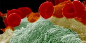 hostpath.jpg Host Pathogen microscopic art